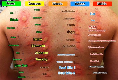 Pin by Bette on Health tips | Dust mite allergy, Dust allergy, Allergy ...