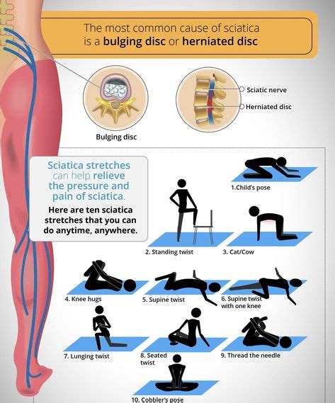 Slipped Disc Exercises