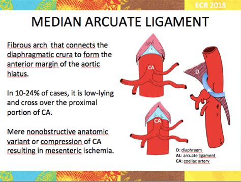 Figure 7 from Complications of vascular impingement in the median ...