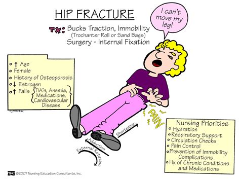 Hip Fractures - Fracture Treatment