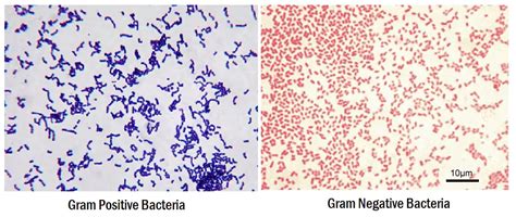 Gram Staining : Principle, Procedure, Interpretation and Animation ...