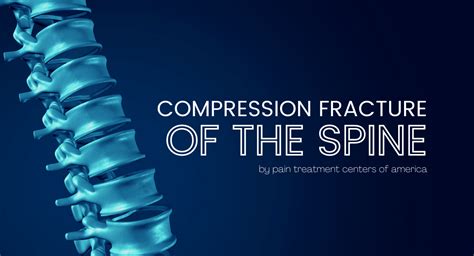 Osteoporosis spinal compression fracture treatment - yaredress