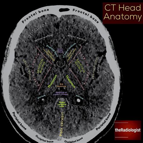 Нет описания фото. | Radiology student, Radiology, Medical anatomy