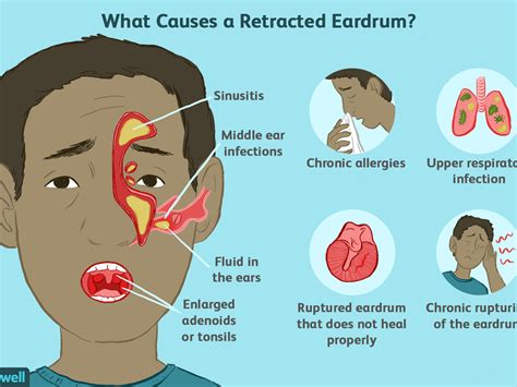 Ear Drum Anatomy