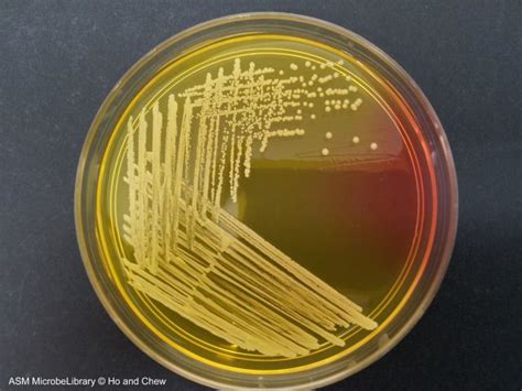 Staphylococcus Epidermidis Streak Plate