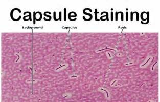 Capsule Staining- Principle, Reagents, Procedure and Result. The main ...