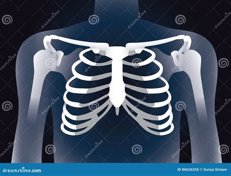 Human Rib Cage in X-ray Image Concept. Stock Vector - Illustration of ...