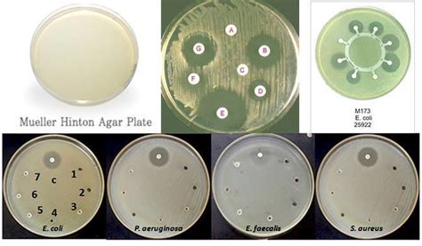 Mueller Hinton agar - Alchetron, The Free Social Encyclopedia