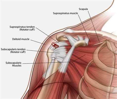 ROTATOR CUFF TENDON INJURY, DIAGNOSIS, TREATMENT AND RECOVERY ...