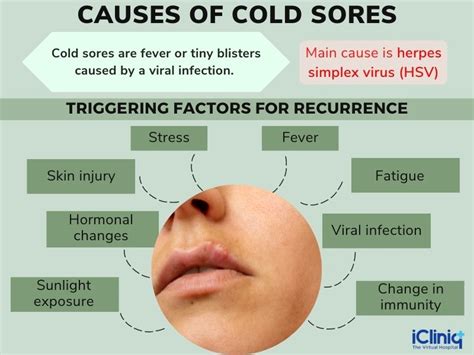 Cold Sores In Mouth