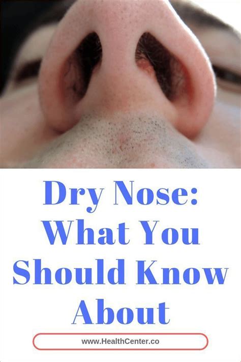 Dry Nose: What You Should Know About | Dry nose, Saline spray, Nasal ...