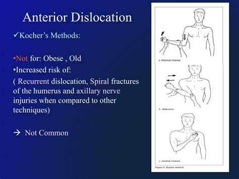 PPT - Shoulder Dislocation PowerPoint Presentation - ID:4841498