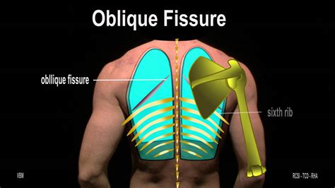 Oblique Fissure Surface Anatomy