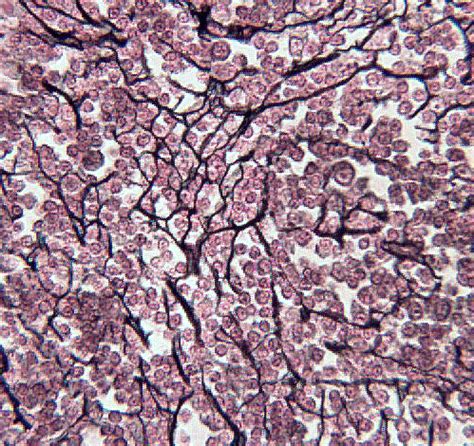 Loose Connective Tissue Reticular