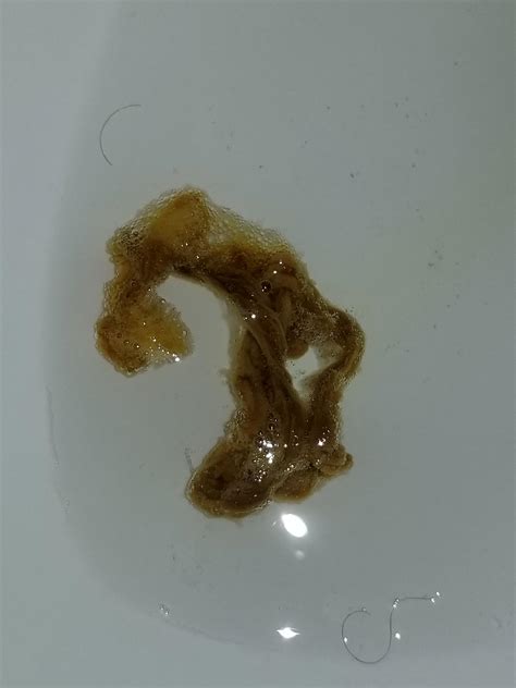 What Do Tapeworms In Human Stool Look Like