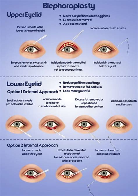 Michigan Eyelid Surgery | Ann Arbor Blepharoplasty