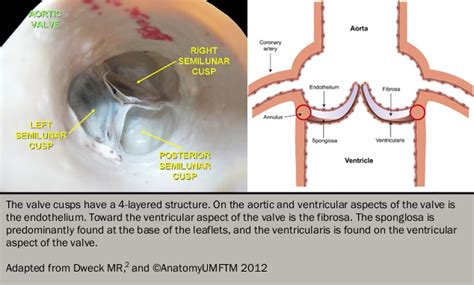 Heart valve disease module 2: pathophysiology | The British Journal of ...