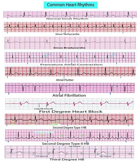 See this Instagram photo by @medical.doctors • 778 likes | Ekg ...