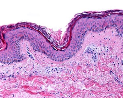 Skin Cell - The Definitive Guide | Biology Dictionary