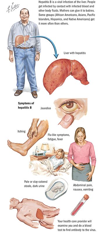 Hepatitis C - Andrea's Digestive Clinic Singapore