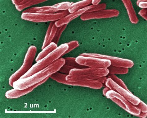 Mycobacterium tuberculosis electron microscopy. SEM micrograph of M ...