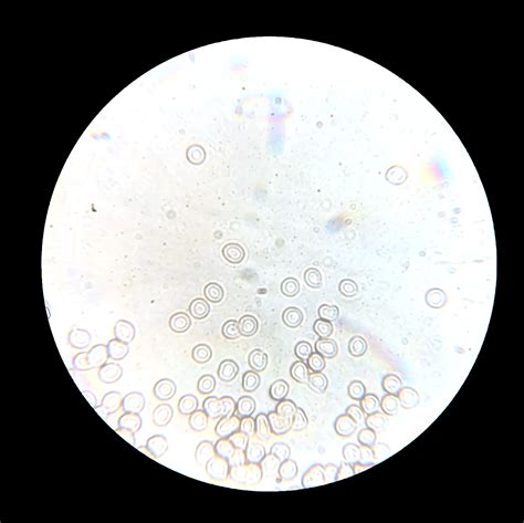 White Blood Cells Under Microscope Labeled