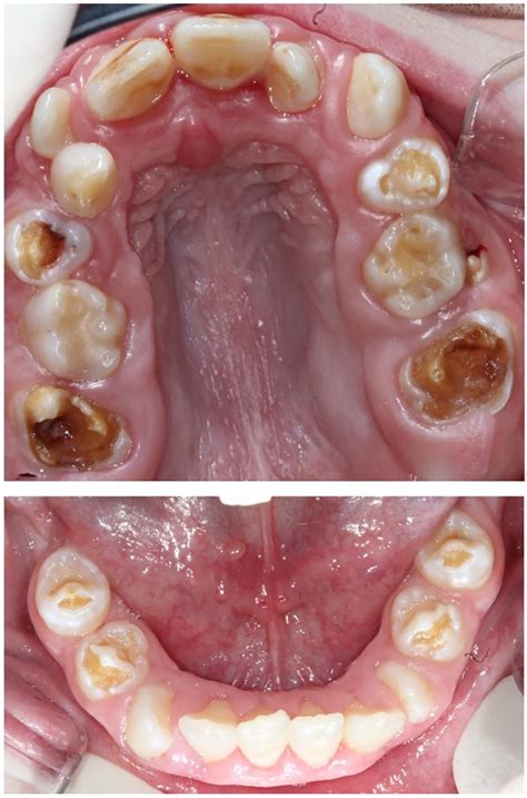 Journal of Clinical Pediatric Dentistry (JOCPD)