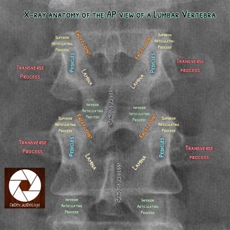 Pin on Rg | Radiology student, Medical radiography, Radiology imaging