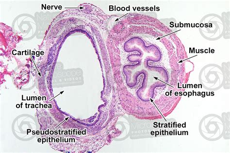 Rat. Esophagus and trachea. Transverse section. 64X - Rat - Mammals ...