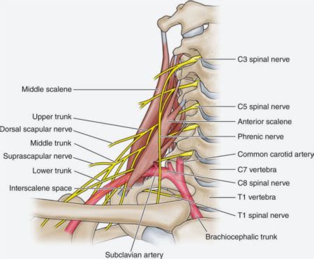 Pinched Nerve From a Car Accident - Pro Chiro