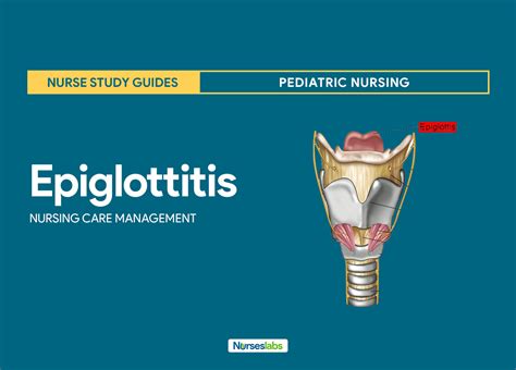 Swollen Epiglottis Treatment