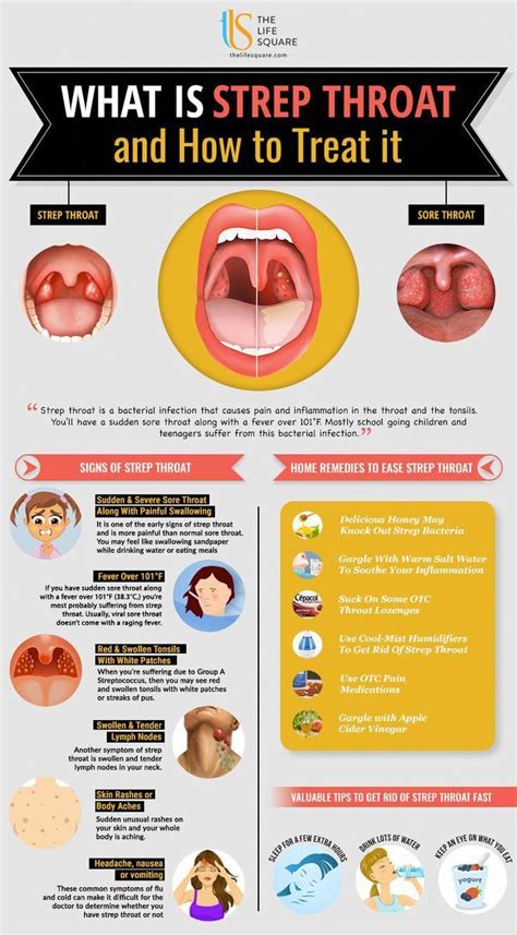 #NaturalColdCuresAndHomeRemedies in 2022 | Strep throat, Signs of strep ...