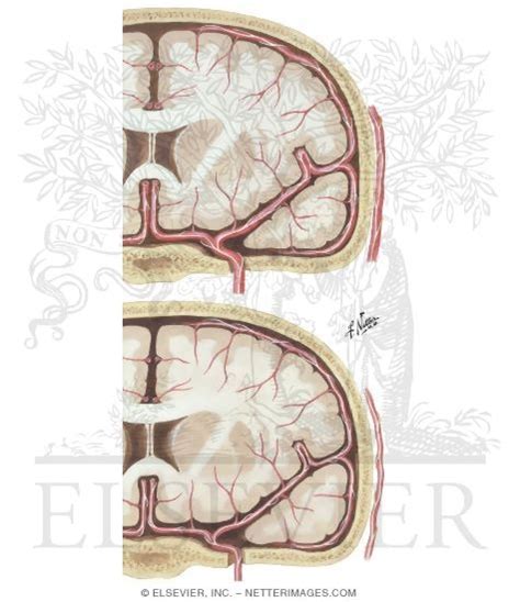 Vascular Theory Migraine: Etiology