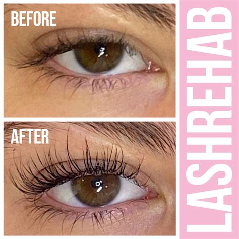 The Lash Rehab - #1 Eyelash Growth Serum