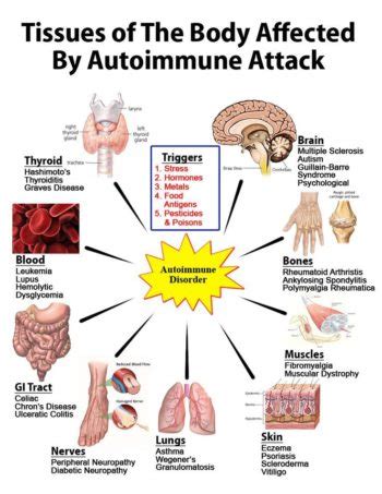 Treatment of Autoimmune Diseases - at the Philadelphia Holistic Clinic