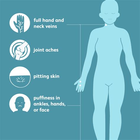 Edema: Symptoms, Causes, Diagnosis, and Treatment