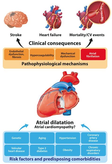 Is left atrium the best kept secret of the heart? Left atrial ...