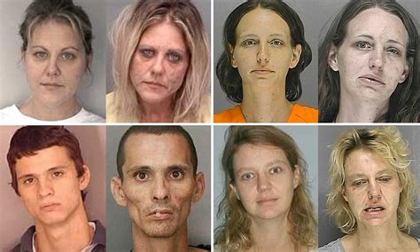 'Faces of Heroin' puts spotlight on physical side effects of drug