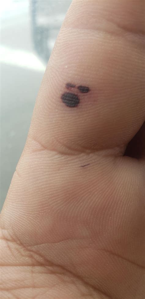 This blood blister on my hand looks like a little face yelling in anger ...