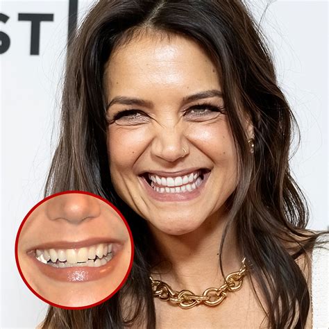 hollywood stars and veneers ( before and after ) - Social Social Social ...