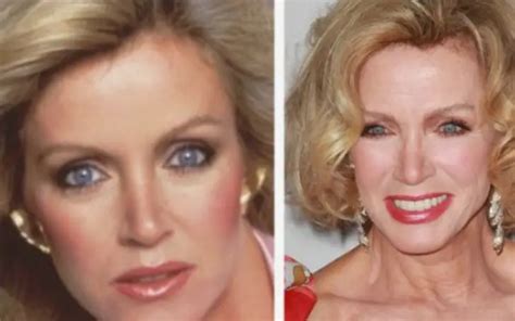 Donna Mills plastic surgery speculations 2022 Before and after - BAE ...