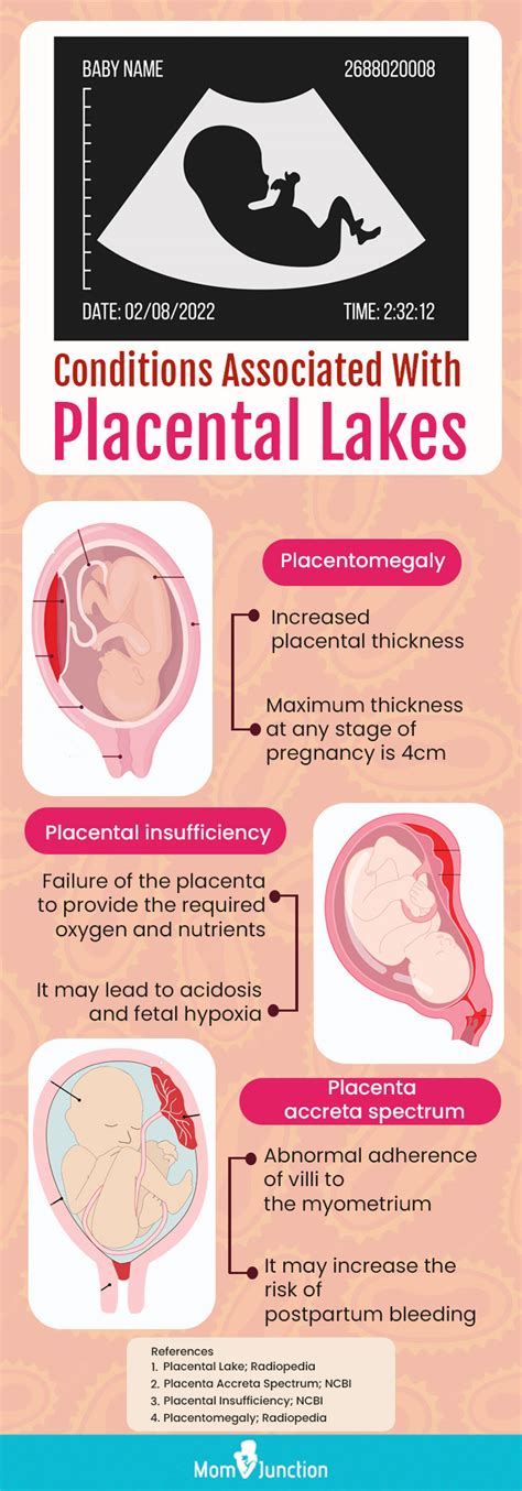 What is A Placental Lake And How It Affects Pregnancy