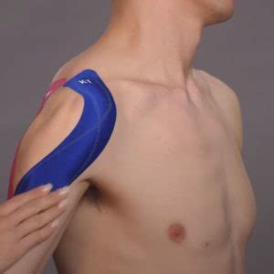 KT Tape Shoulder: Facts You Need to Know! - Centeno-Schultz