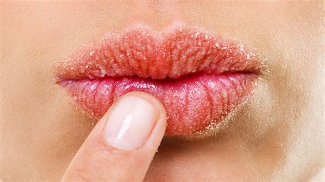 Dry Lips: The Causes, Treatments and Products To Try Now | Glamour UK