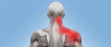 Neck & Shoulder Pain