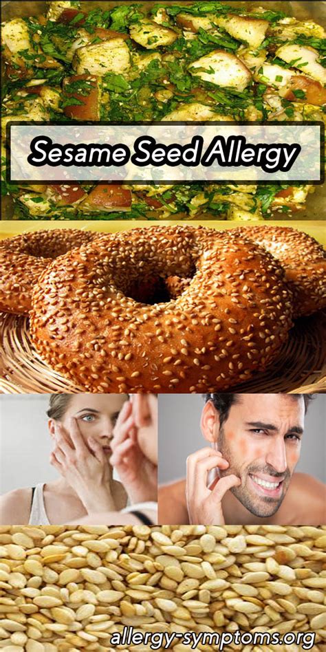 Sesame Seed Allergy Symptoms at Lee Porter blog