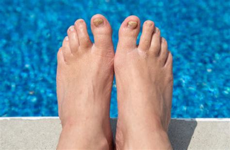 Aging Feet: Natural Changes and Care