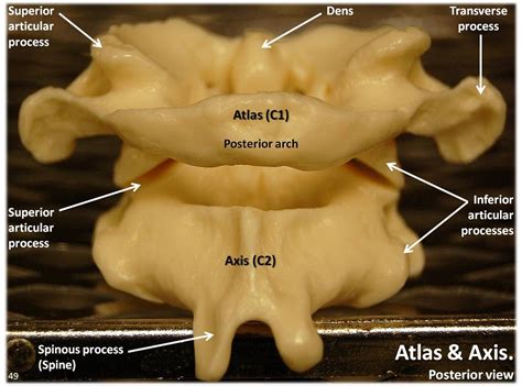 Atlas C1 and Axis C2 vertebrae, posterior view with labels… | Flickr