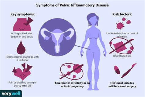 Pelvic Inflammatory Disease: Symptoms, Causes, Treatment