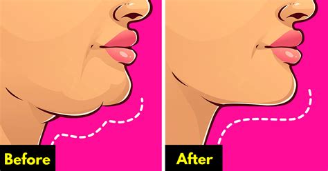 15 Best Double Chin Exercises - Stylinggo